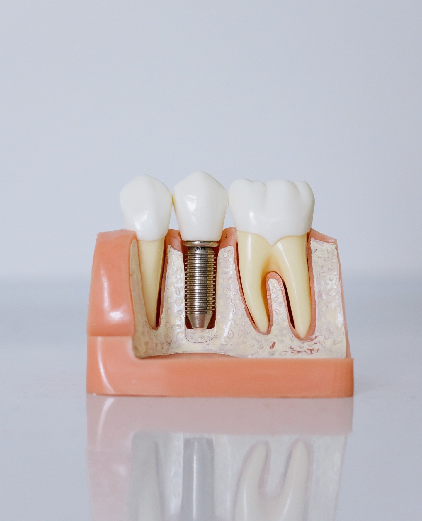 Dental care at Lumi